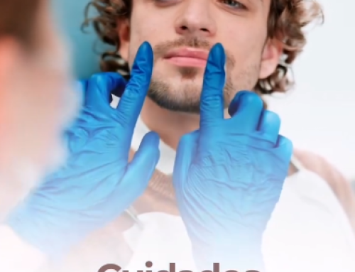 🦷 Cuidados pós-faceta: garanta o melhor sorriso por mais tempo!