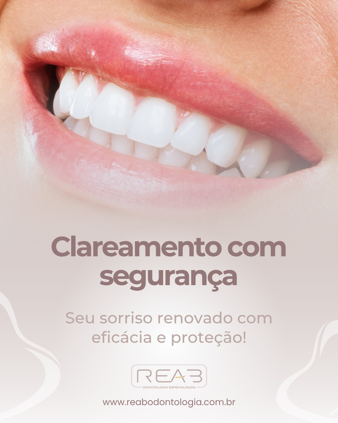 Clareamento