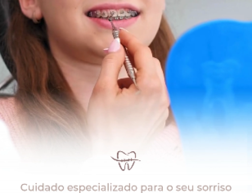 😁 Ortodontia e aparelhos: cuidado especializado para o seu sorriso