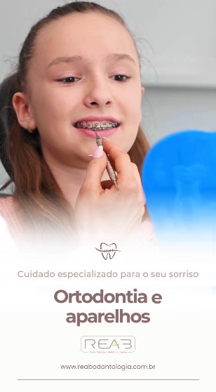 Ortodontia e aparelho