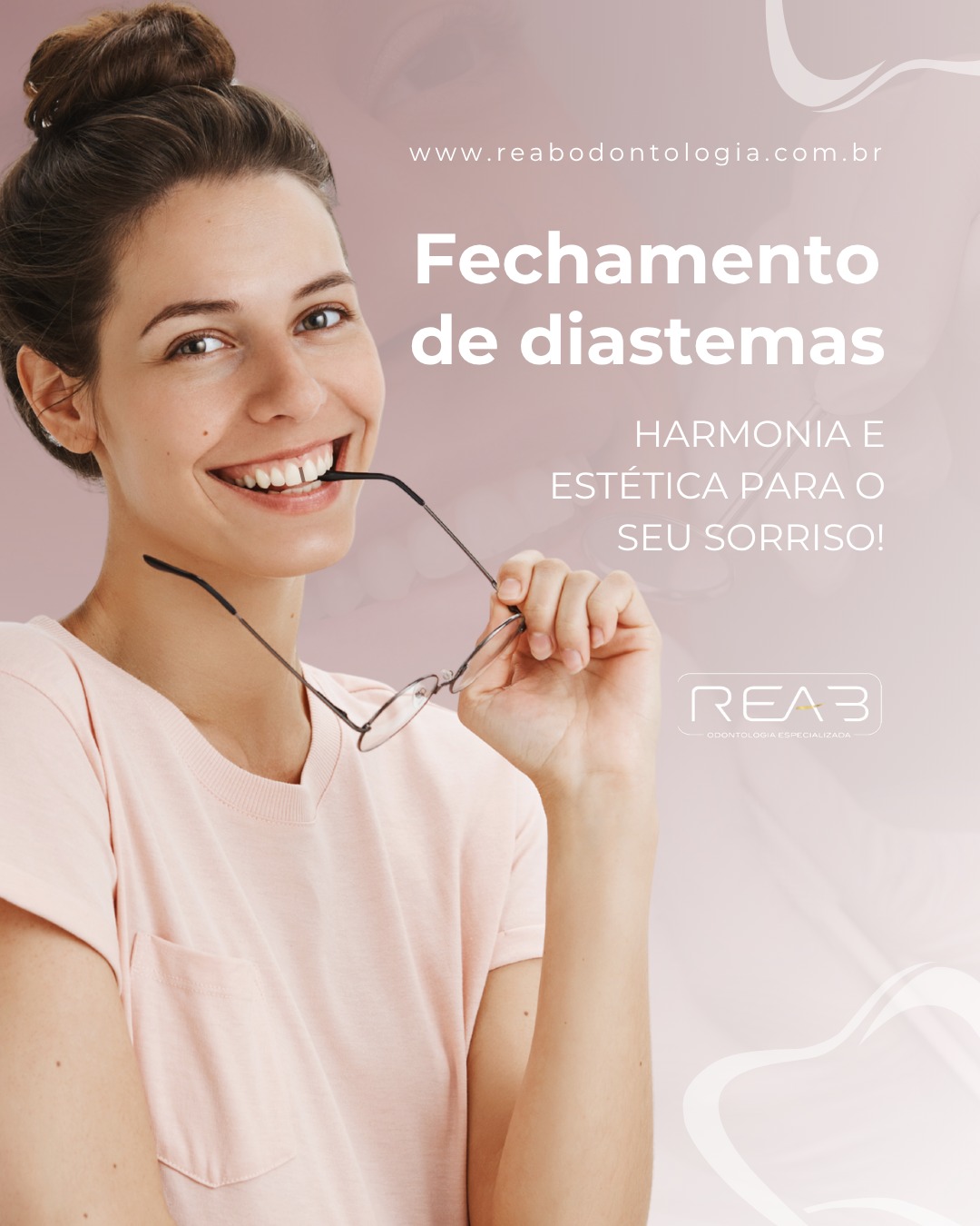 O fechamento de diastemas